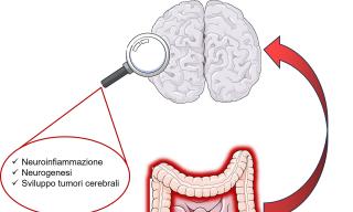 asse intestino cervello